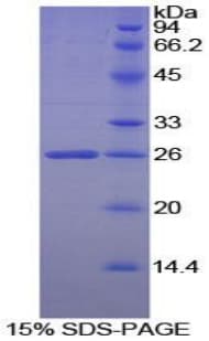 Human HPSE / Heparanase Protein (Recombinant His)