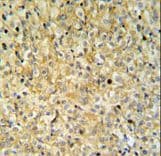 MAPK1IP1L Antibody (aa108-137)