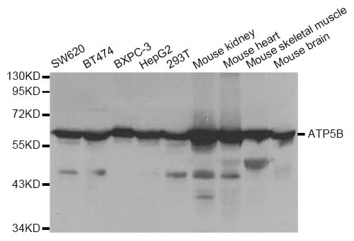 IHC-plus™ ATP5B / ATP Synthase Beta Antibody