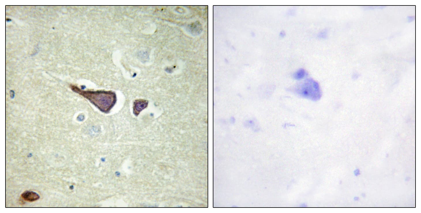 Polyclonal Rabbit anti-Human IGF2R / CD222 Antibody (aa2381-2430, IHC, IF)