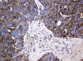 GLB1 / Beta-Galactosidase Antibody (clone OTI1C9)