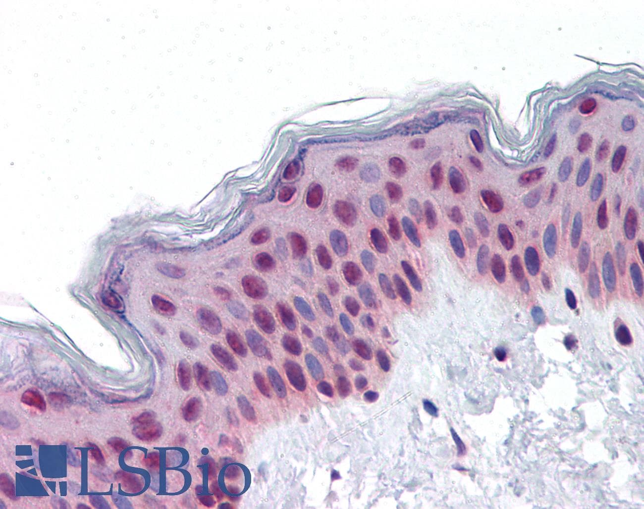 IHC-plus™ TIP48 / RUVBL2 Antibody