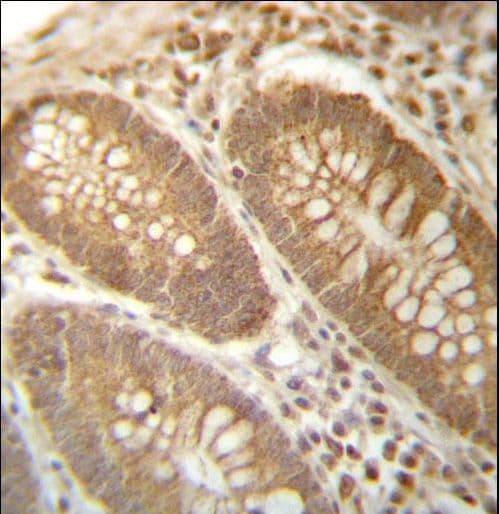 Polyclonal Rabbit anti-Human PGAM4 Antibody (aa25-53, IHC, WB)
