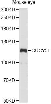 GUCY2F Antibody