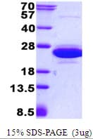 Human CNRIP1 Protein (Recombinant His)