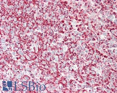 IHC-plus™ TSPO / PBR Antibody (C-Terminus)