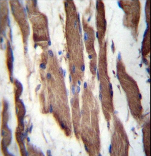 Polyclonal Rabbit anti-Human TGFBRAP1 / TRAP-1 Antibody (aa499-528, IHC, WB)
