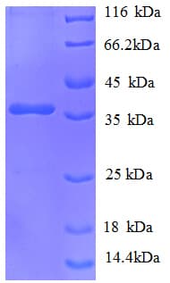 E. coli YdhF / Oxidoreductase Protein (Recombinant His)
