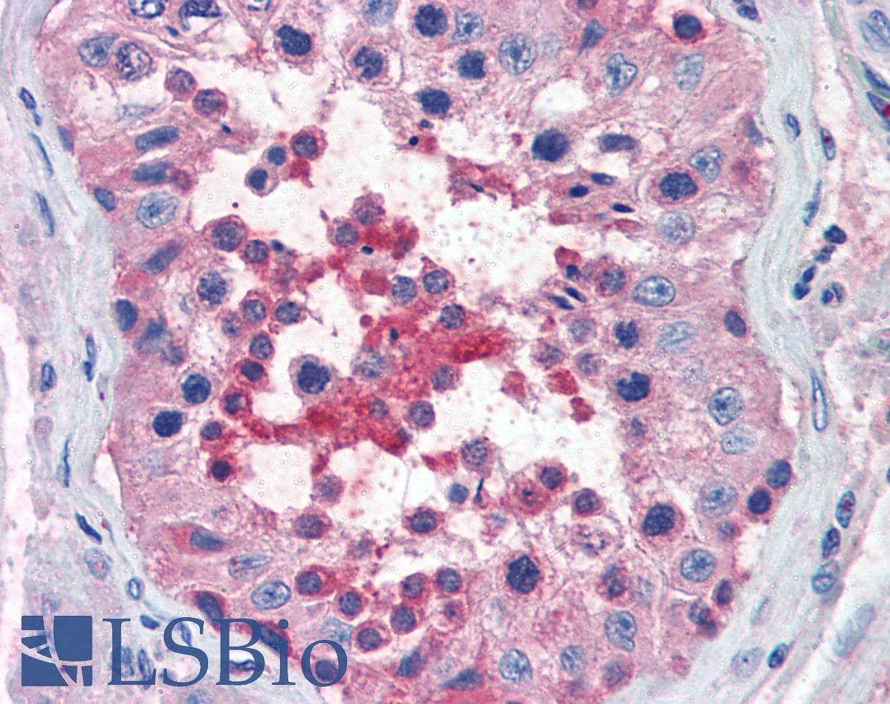 IHC-plus™ CXCR4 Antibody (aa14-40)