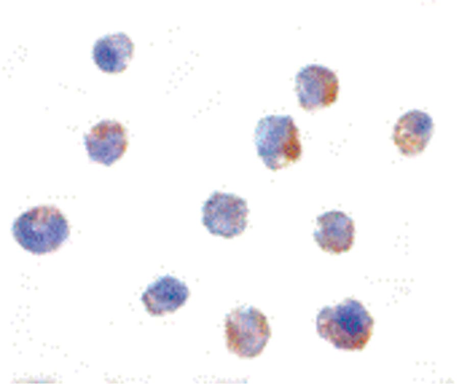 IHC-plus™ Polyclonal Rabbit anti-Human IKBKAP / IKAP Antibody (IHC, IF, WB)