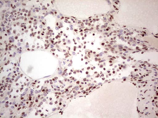 Monoclonal Mouse anti-Human NR3C1/Glucocorticoid Receptor Antibody (clone OTI6B5, aa1-265, IHC, WB)