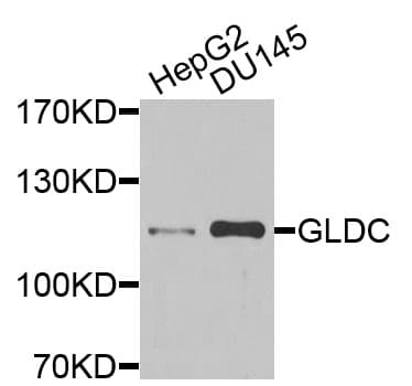 Polyclonal Rabbit anti-Human GLDC Antibody (WB)