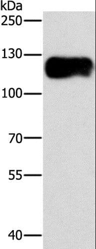 CAST / Calpastatin Antibody