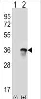 U2AF1 Antibody (aa99-125)