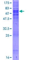 Human SEC61A1 / SEC61 Protein (Recombinant GST)