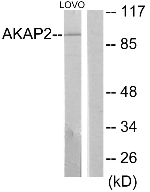 AKAP2 Antibody (aa71-120)