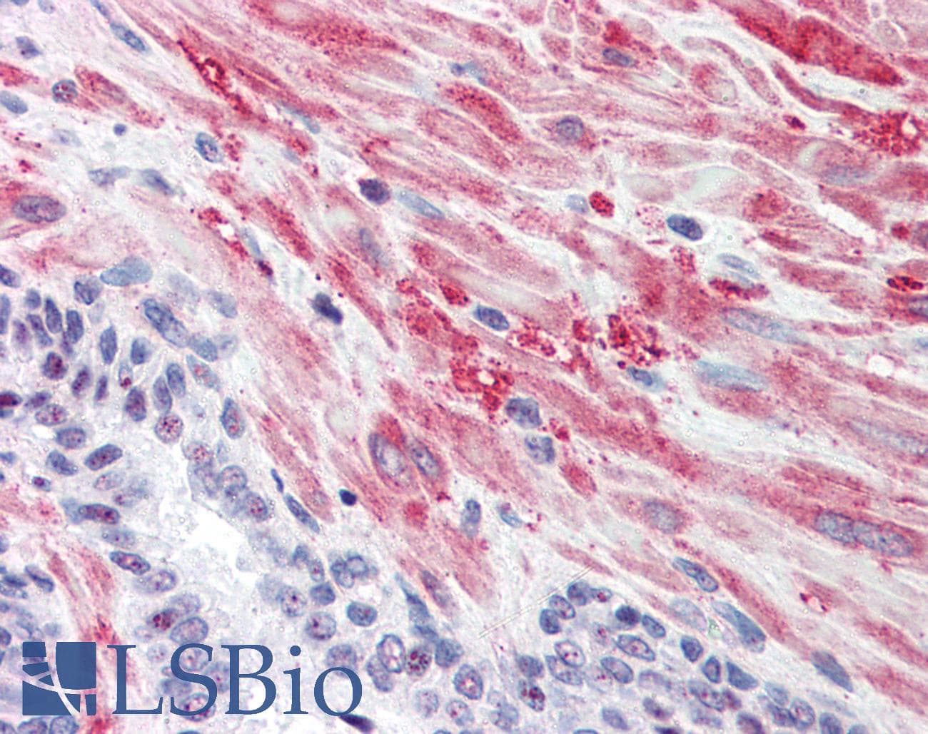 IHC-plus™ GYS1 / Glycogen Synthase Antibody (phospho-Ser640)