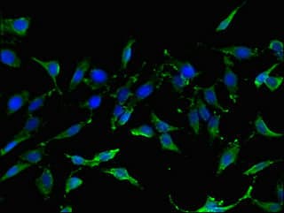 Polyclonal Rabbit anti-Human TIGAR Antibody (IHC, IF)