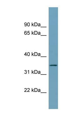 SDCBP / Syntenin Antibody (aa215-264)