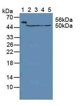 FH / Fumarase / MCL Antibody (aa42-185, PE)