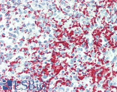 IHC-plus™ GP1BA / CD42b Antibody