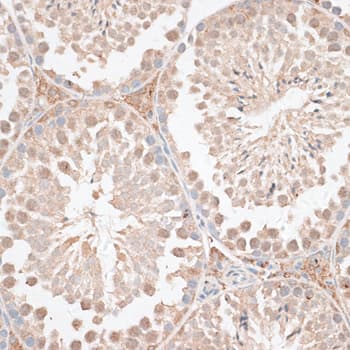 KDR / VEGFR2 / FLK1 Antibody
