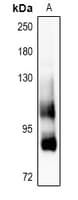 Polyclonal Rabbit anti-Human LRP1 / CD91 Antibody (IHC, WB)