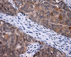 LIPG / Endothelial Lipase Antibody (clone OTI2D5)