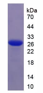 Rhesus monkey IL6 / Interleukin 6 Protein (Recombinant His)