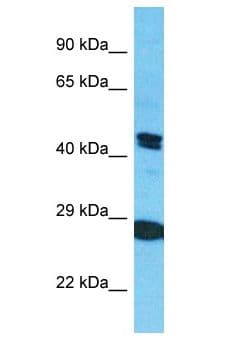 KRT80 / Keratin 80 Antibody (aa401-450)
