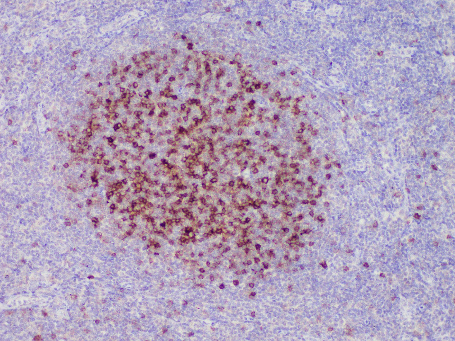 FCER2 / CD23 Antibody