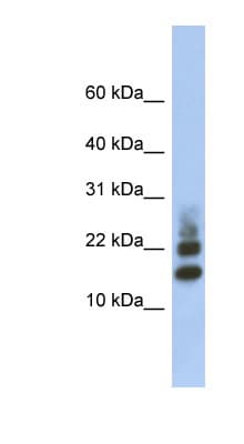 RPS15A Antibody (aa71-120)