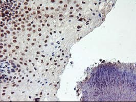 PPP1R15A / GADD34 Antibody (clone OTI3D12)