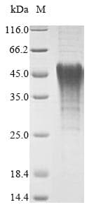 Mouse NIP3 / BNIP3 Protein (Recombinant 6His, N-terminus)