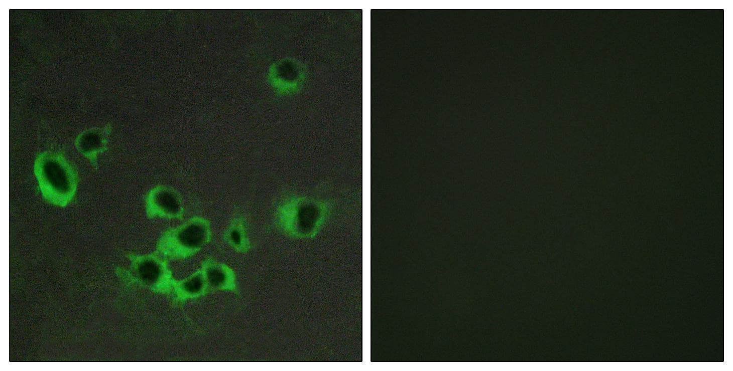 HTR2B / 5-HT2B Receptor Antibody