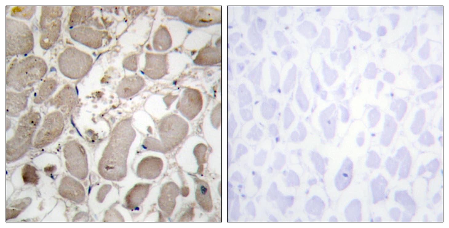 COL5A1 / Collagen V Alpha 1 Antibody (aa301-350)
