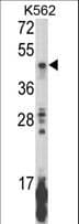 Polyclonal Rabbit anti-Human KIR2DL5B Antibody (aa264-290, IHC, WB)