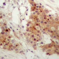 IRF3 Antibody (C-Terminus)