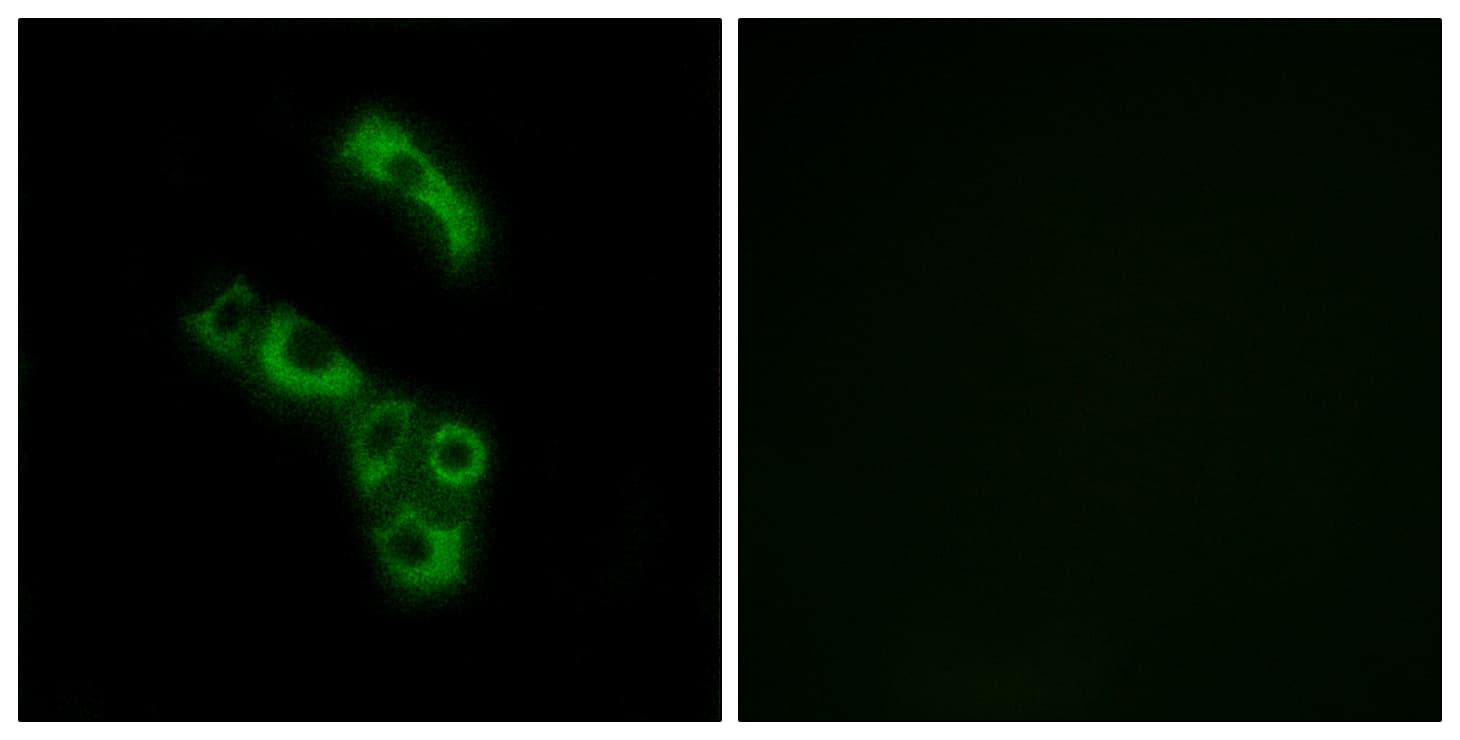 Polyclonal Rabbit anti-Human Complement C1QB Antibody (aa161-210, IF, WB)