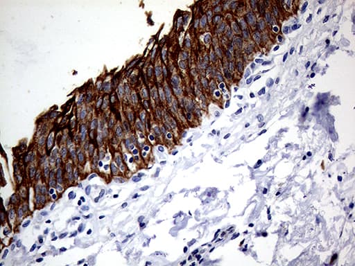 KRT8 / CK8 / Cytokeratin 8 Antibody (aa91-381, clone OTI2F5)