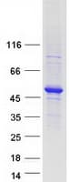 Human TADA3 / ADA3 Protein (Recombinant Myc-DDK (Flag))
