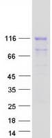 Human AMOTL2 Protein (Recombinant Myc-DDK (Flag))