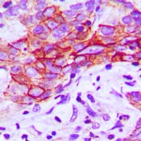 IHC-plus™ Polyclonal Rabbit anti-Human CHEMR23 / CMKLR1 Antibody (Internal, IHC, WB)