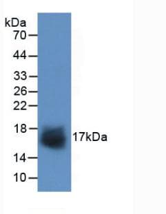 SNCA / Alpha-Synuclein Antibody (aa5-140)