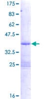 Human PDE6H Protein (Recombinant GST)