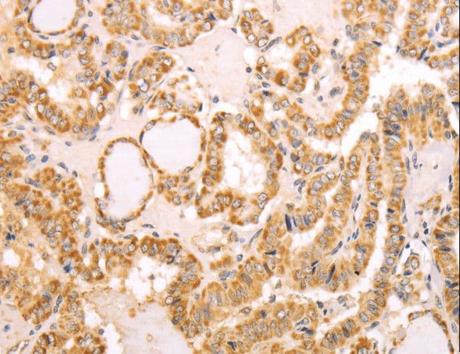 NAMPT / Visfatin Antibody