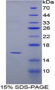 Mouse PPARG / PPAR Gamma Protein (Recombinant His)