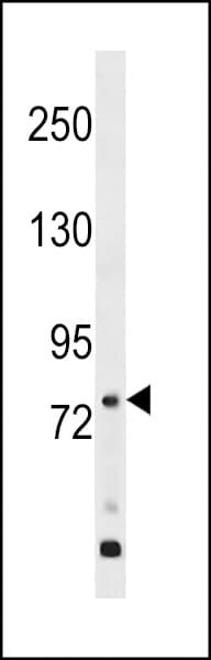 Polyclonal Rabbit anti-Human GPR149 / PGR10 Antibody (aa421-449, WB)