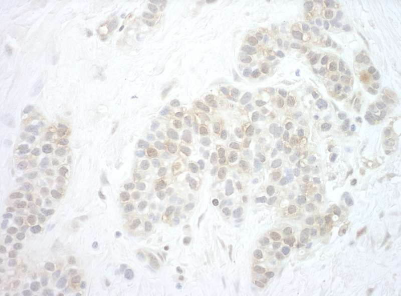 Polyclonal Rabbit anti-Human PYGO2 / Pygopus 2 Antibody (aa356-406, IHC)