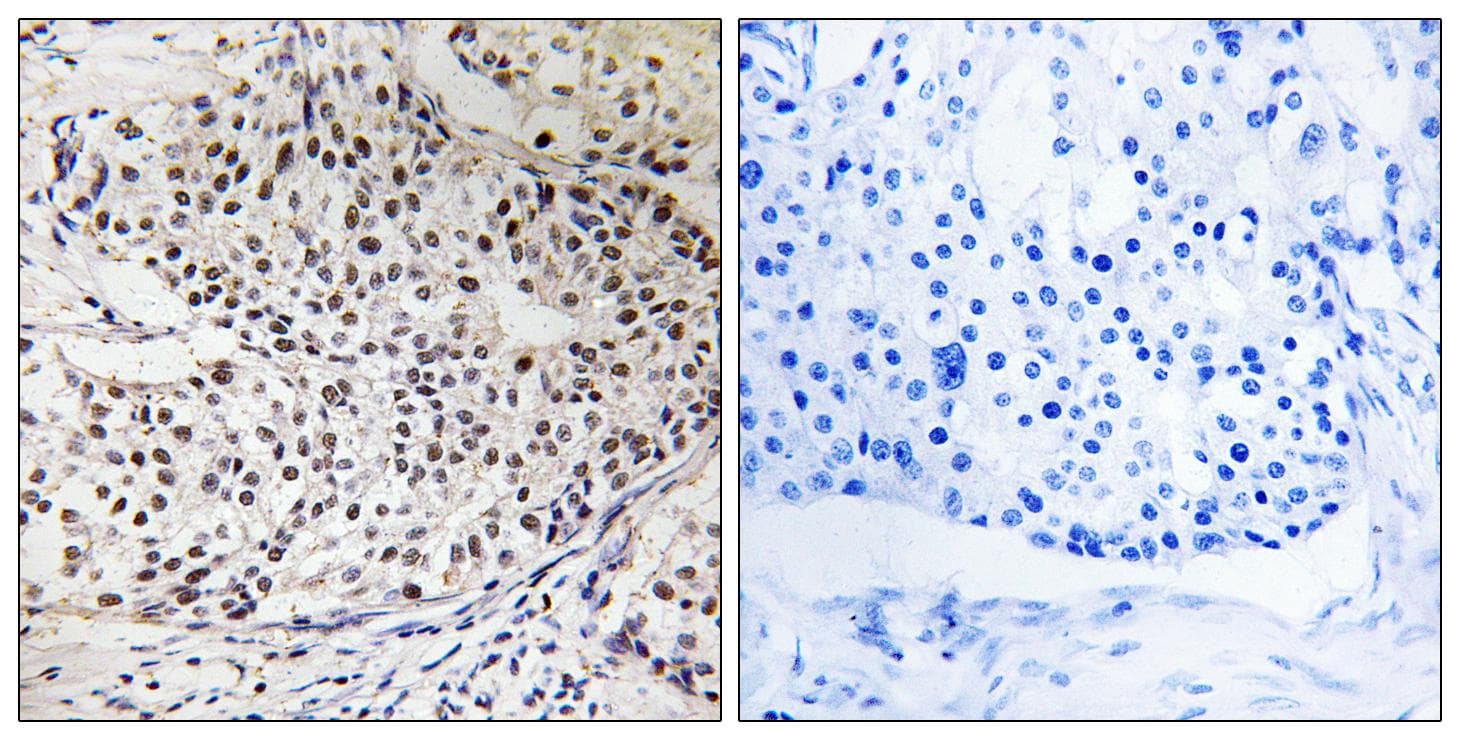 RAD51 / RECA Antibody (phospho-Thr309)